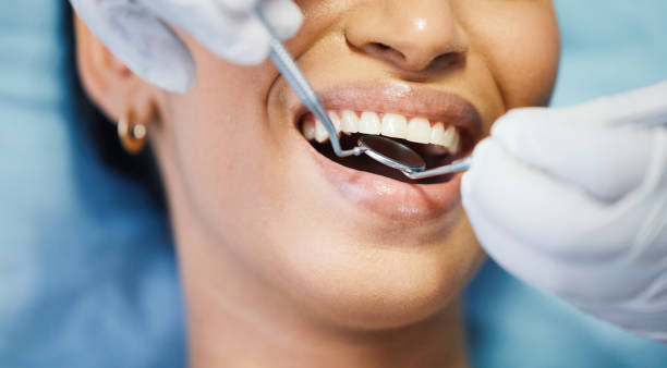 Best Emergency Dental Care for Broken or Chipped Teeth in North Enid, OK